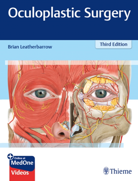 Oculoplastic Surgery (e-bog) af Leatherbarrow, Brian