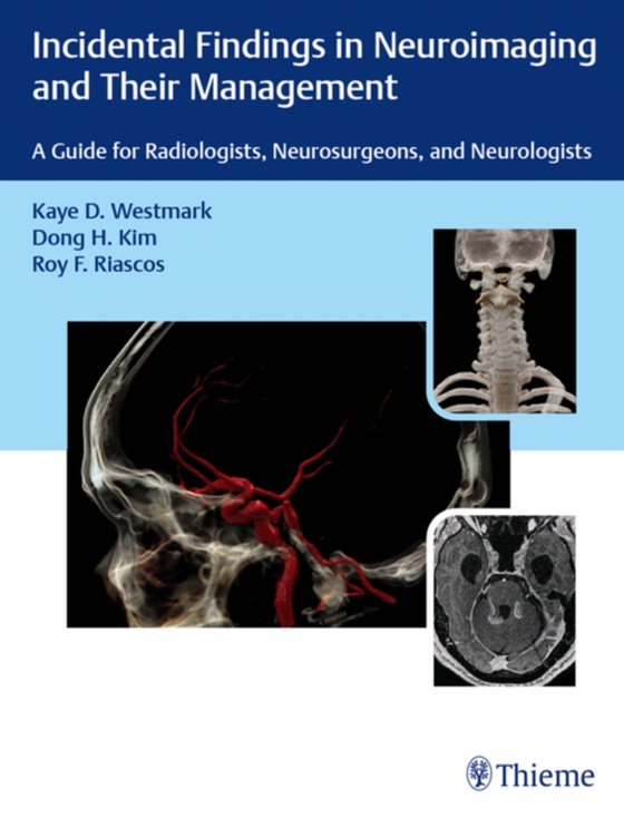 Incidental Findings in Neuroimaging and Their Management (e-bog) af Riascos-Castaneda, Roy F.