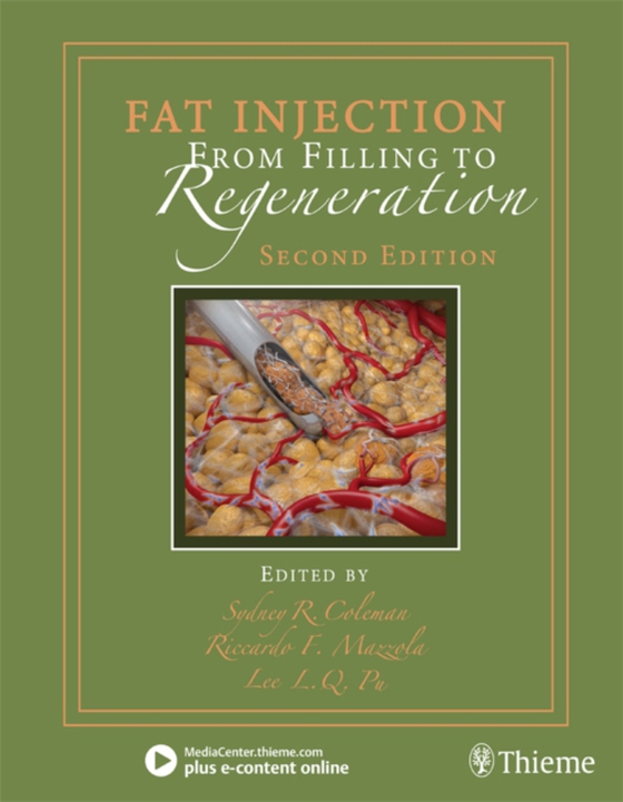 Fat Injection (e-bog) af -