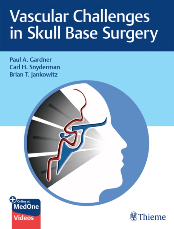 Vascular Challenges in Skull Base Surgery (e-bog) af Jankowitz, Brian T.