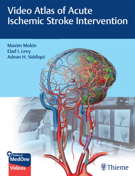 Video Atlas of Acute Ischemic Stroke Intervention (e-bog) af Siddiqui, Adnan H.