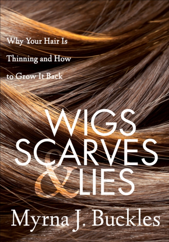 Wigs, Scarves & Lies (e-bog) af Buckles, Myrna J.