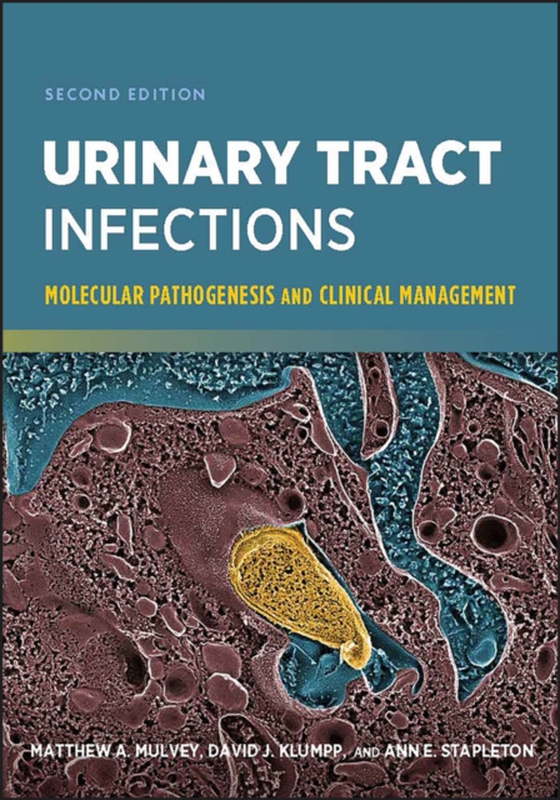 Urinary Tract Infections (e-bog) af Stapleton, Ann E.