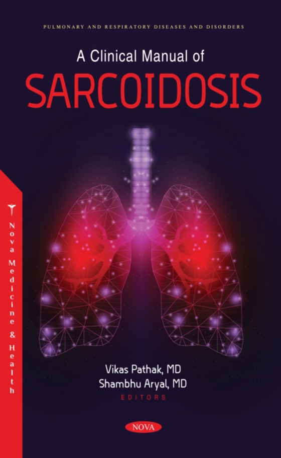 Clinical Manual of Sarcoidosis (e-bog) af -