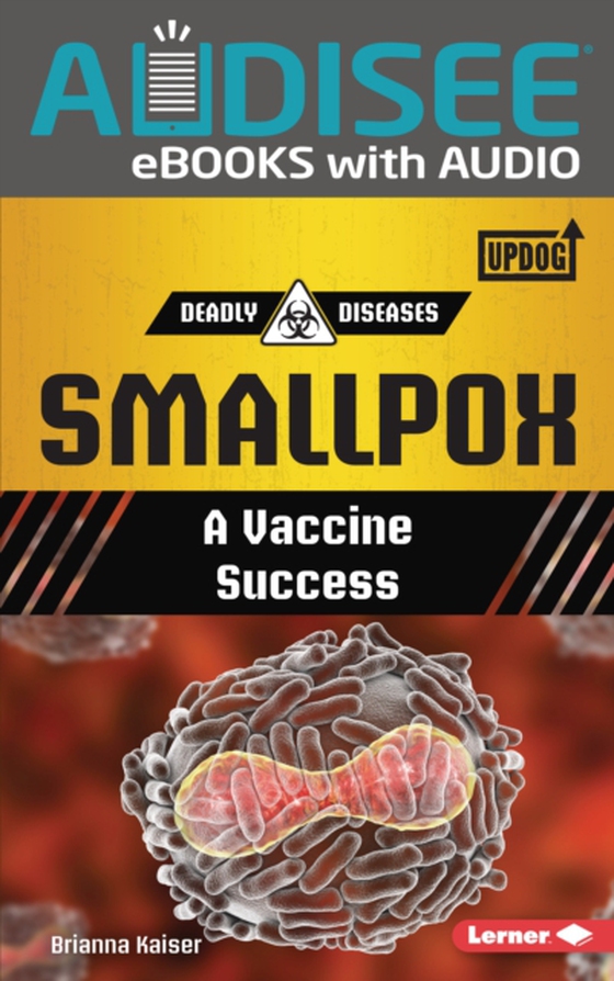 Smallpox