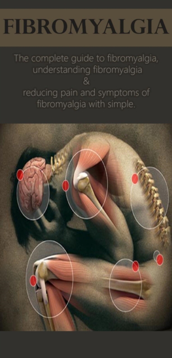 Fibromyalgia (e-bog) af Anthony, David