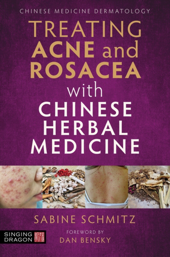 Treating Acne and Rosacea with Chinese Herbal Medicine (e-bog) af Schmitz, Sabine