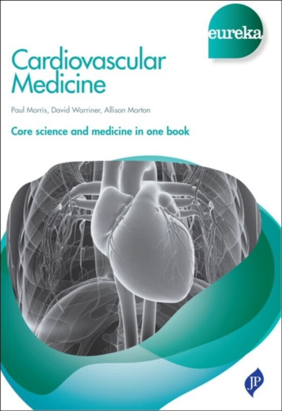 Eureka: Cardiovascular Medicine (e-bog) af Morton, Allison