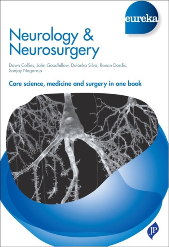 Eureka: Neurology & Neurosurgery (e-bog) af Nagaraja, Sanjoy