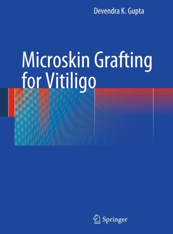 Microskin Grafting for Vitiligo (e-bog) af Gupta, Devendra K.