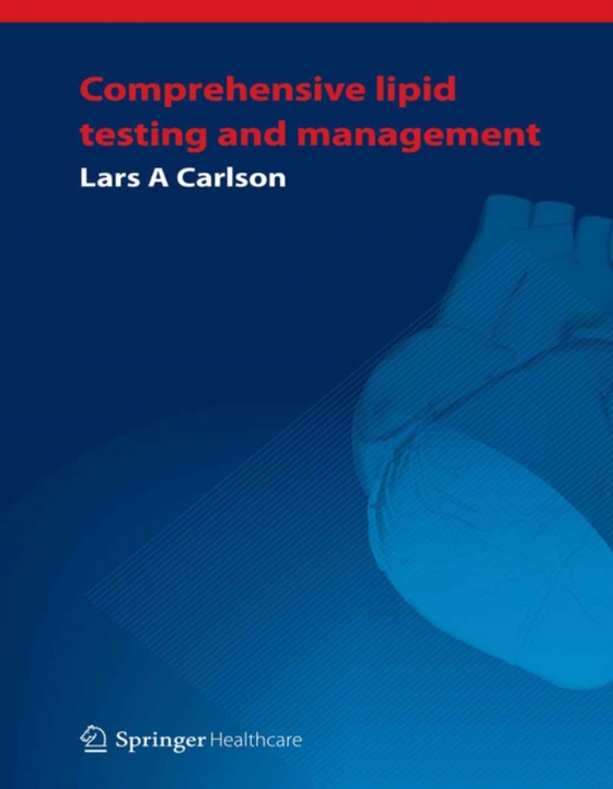 Comprehensive lipid testing and management (e-bog) af Carlson, Lars