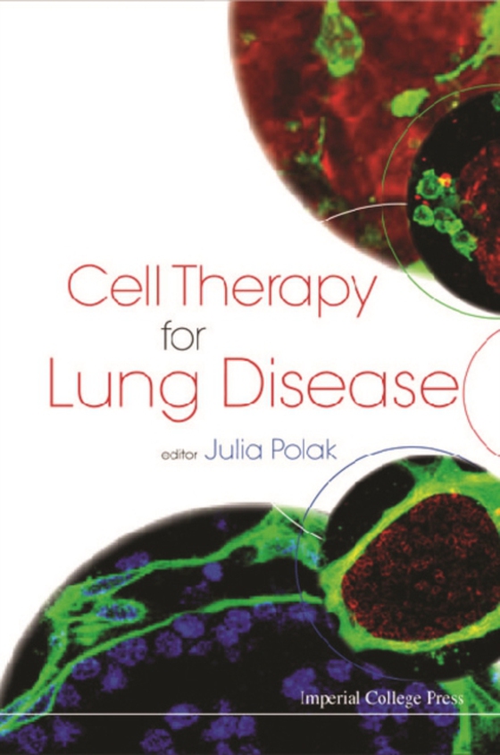 Cell Therapy For Lung Disease (e-bog) af -