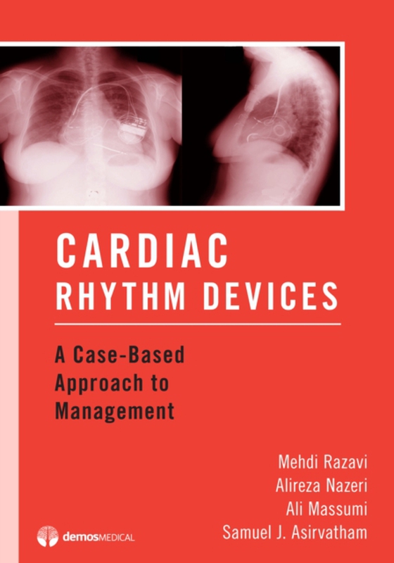 Cardiac Rhythm Devices (e-bog) af Mehdi Razavi, MD
