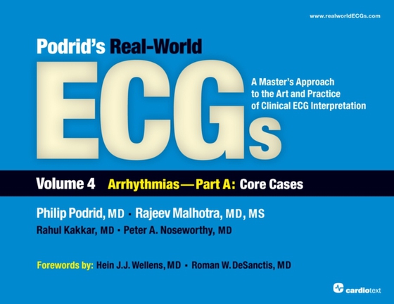 Podrid's Real-World ECGs: Volume 4A, Arrhythmias [Core Cases] (e-bog) af Kakkar, Rahul