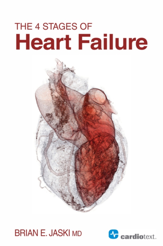 4 Stages of Heart Failure (e-bog) af Jaski, Brian