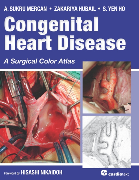 Congenital Heart Disease: A Surgical Color Atlas (e-bog) af Ho, S. Yen