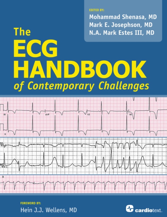 ECG Handbook of Contemporary Challenges (e-bog) af -