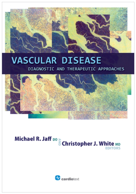 Vascular Disease: Diagnostic and Therapeutic Approaches