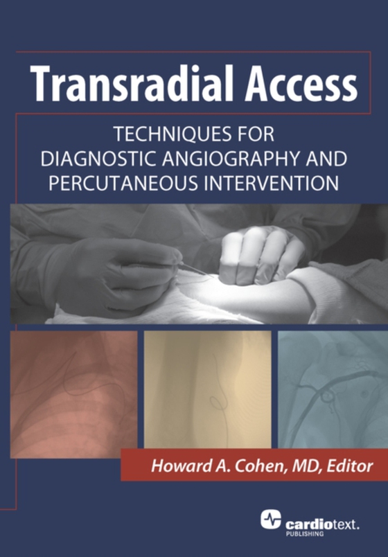 Transradial Access: Techniques for Diagnostic Angiography and Percutaneous Intervention (e-bog) af -