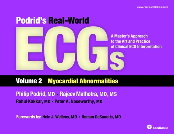 Podrid's Real-World ECGs: Volume 2, Myocardial Abnormalities (e-bog) af Kakkar, Rahul