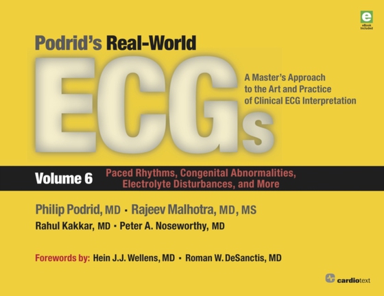 Podrid's Real-World ECGs: Volume 6, Paced Rhythms, Congenital Abnormalities, Electrolyte Disturbances, and More (e-bog) af Kakkar, Rahul