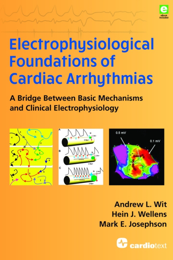 Electrophysiological Foundations of Cardiac Arrhythmias (e-bog) af Josephson, Mark E.