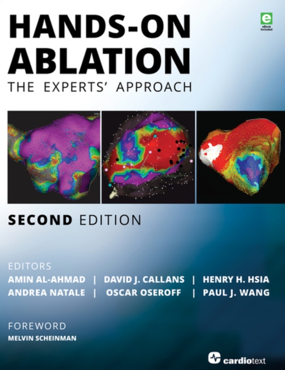 Hands-On Ablation (e-bog) af -