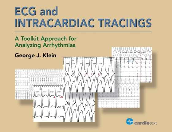 ECG and Intracardiac Tracings (e-bog) af Klein, George J.