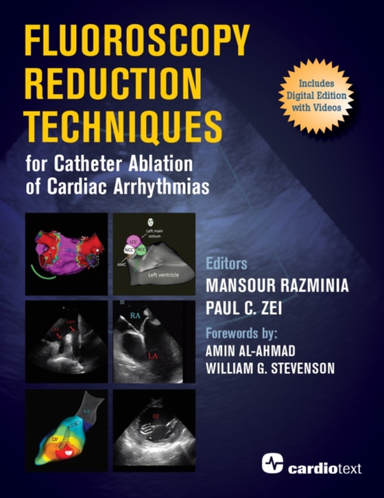 Fluoroscopy Reduction Techniques for Catheter Ablation of Cardiac Arrhythmias (e-bog) af -