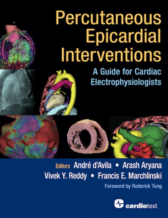 Percutaneous Epicardial Interventions: (e-bog) af -