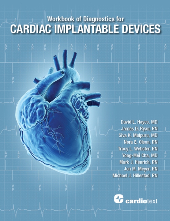 Workbook of Diagnostics for Cardiac Implantable Devices (e-bog) af Mulpuru, Siva