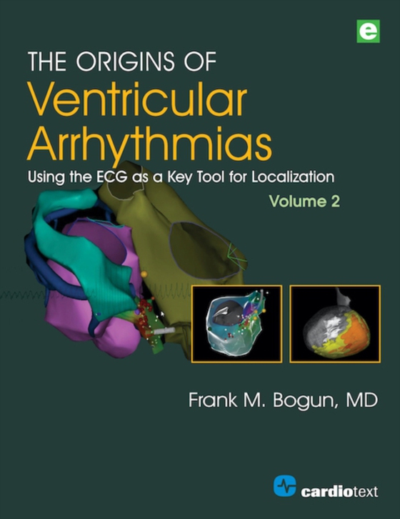 Origins of Ventricular Arrhythmias, Volume 2 (e-bog) af Bogun, Frank M.