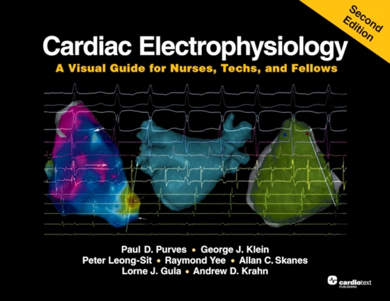 Cardiac Electrophysiology: A Visual Guide for Nurses, Techs, and Fellows, Second Edition (e-bog) af Leong-Sit, Dr. Peter