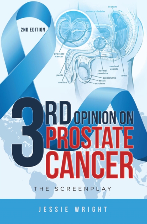 3rd Opinion on Prostate Cancer (e-bog) af Wright, Jessie