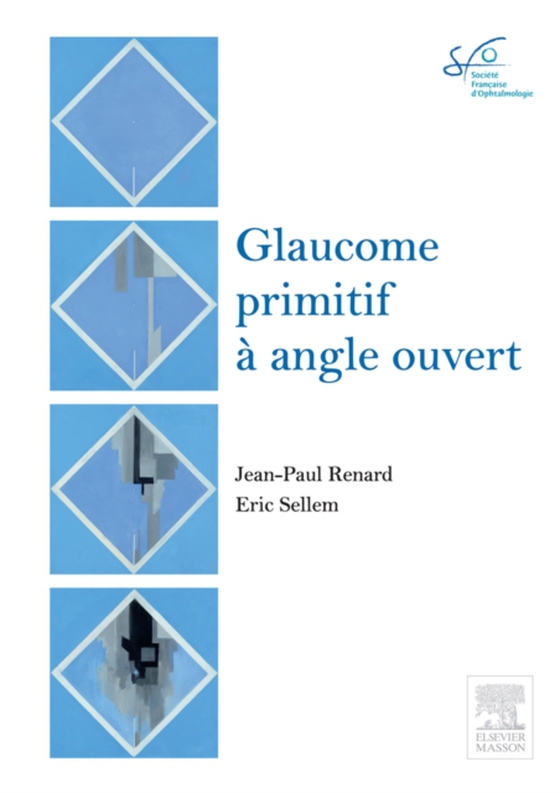 Glaucome primitif à angle ouvert (e-bog) af Sellem, Eric