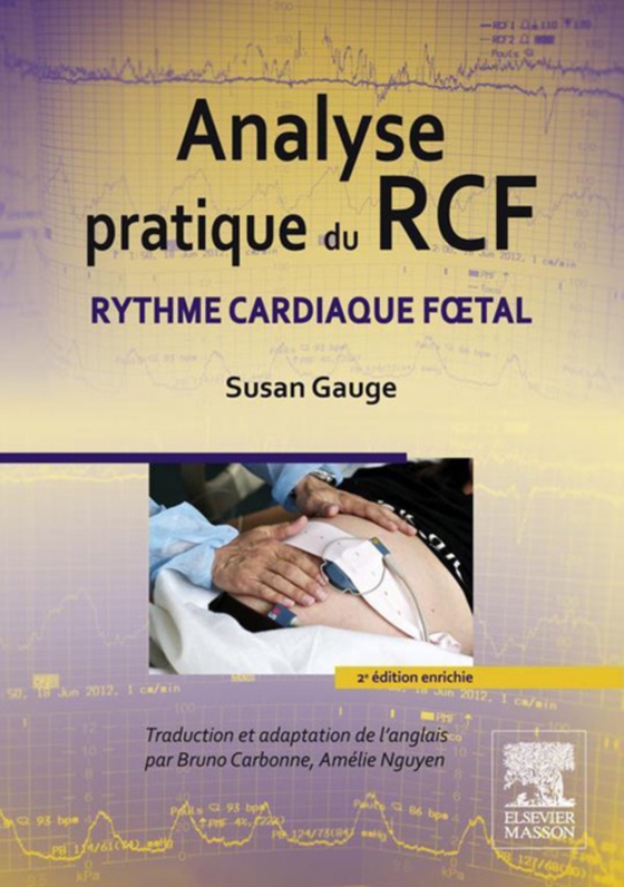 Analyse pratique du RCF (e-bog) af Nguyen, Amelie