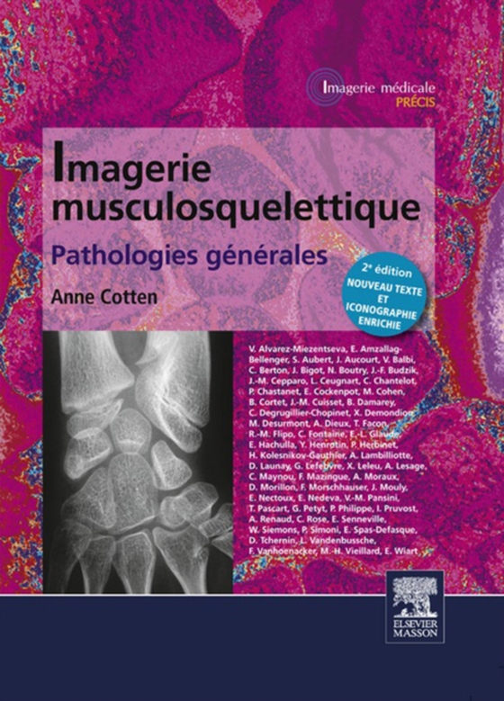 Imagerie musculosquelettique : pathologies générales (e-bog) af Cotten, Anne