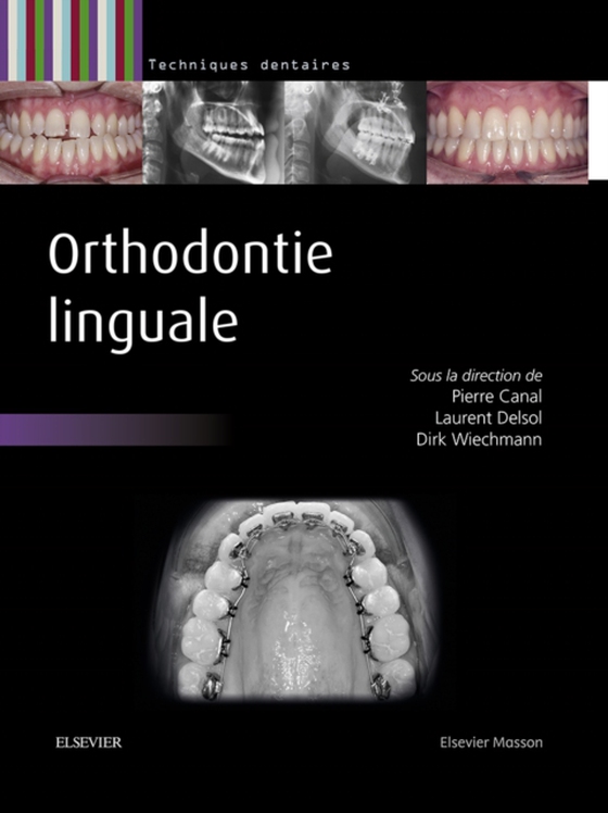 Orthodontie linguale (e-bog) af Wiechmann, Dirk