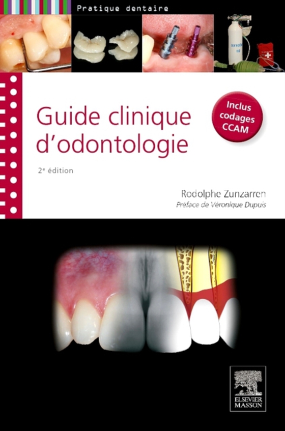 Guide clinique d'odontologie (e-bog) af Zunzarren, Rodolphe