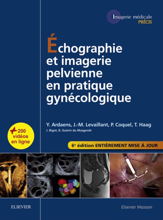 Échographie et imagerie pelvienne en pratique gynécologique (e-bog) af Haag, Thierry