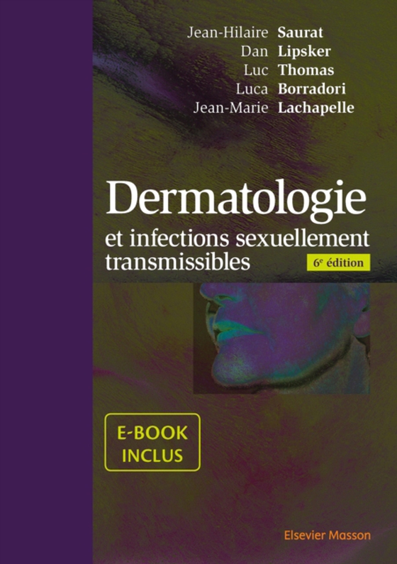 Dermatologie et infections sexuellement transmissibles (e-bog) af Thomas, Luc