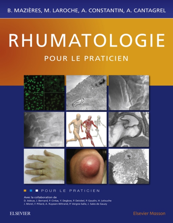 Rhumatologie pour le praticien (e-bog) af Mazieres, Bernard