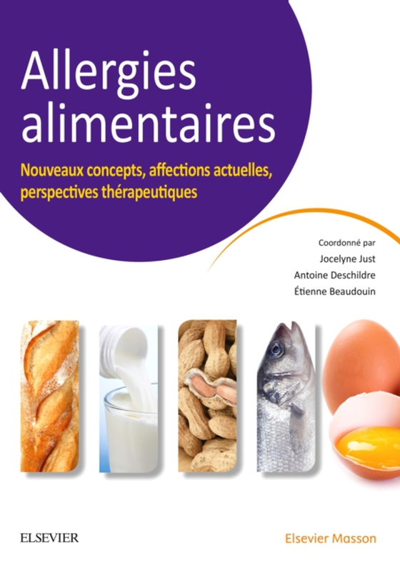 Allergies alimentaires (e-bog) af Beaudouin, Etienne