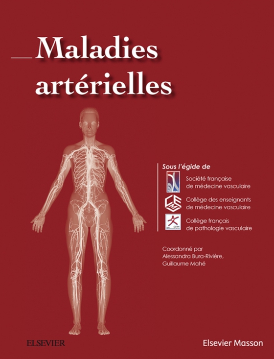 Maladies artérielles