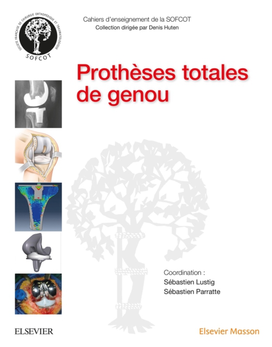 Prothèses totales de genou PACK NON COMMERCIALISE (e-bog) af Parratte, Sebastien