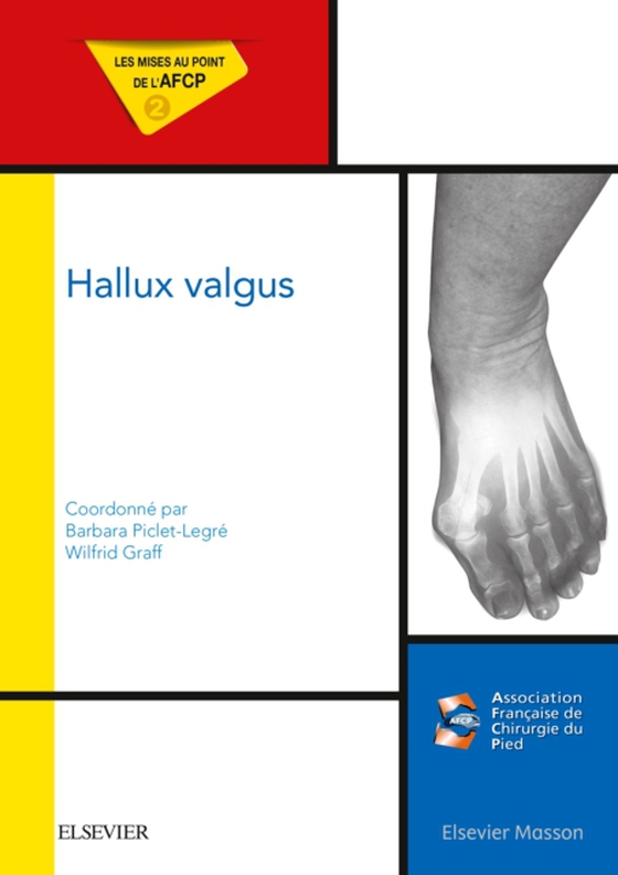 Hallux valgus (e-bog) af Graff, Wilfrid