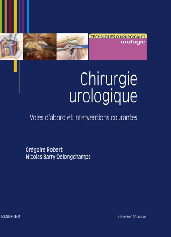 Chirurgie urologique (e-bog) af Delongchamps, Nicolas Barry