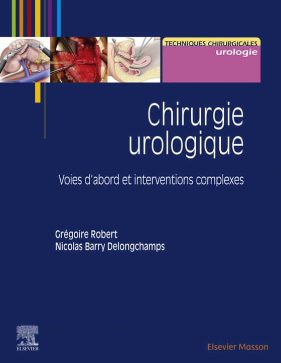 Chirurgie urologique (e-bog) af Delongchamps, Nicolas Barry