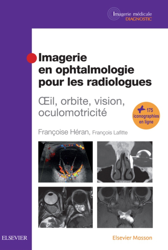 Imagerie en ophtalmologie pour les radiologues (e-bog) af Lafitte, Francois