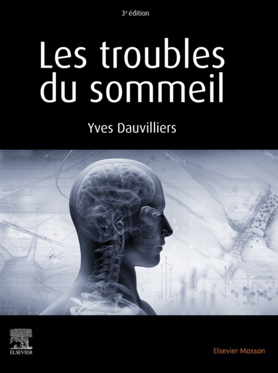 Les troubles du sommeil (e-bog) af Dauvilliers, Yves